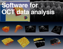 Software for OCT data analysis